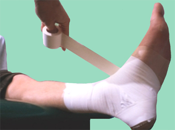 Kinestaping en Fisioterapia NOAL